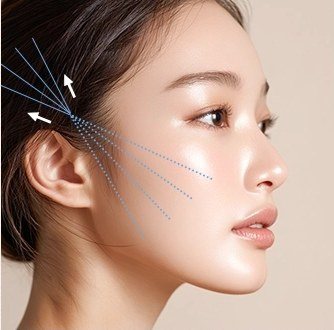 실 끌어올려 고정하는 단계 일러스트