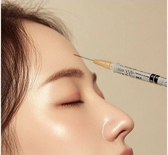 이마 부위에 주사 시술을 진행하는 모습