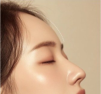 정돈된 이마 볼륨 곡선을 확인하는 여성의 옆모습