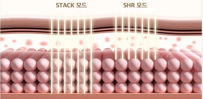 피부층에 적용되는 STACK 모드와 SHR 모드 비교 일러스트