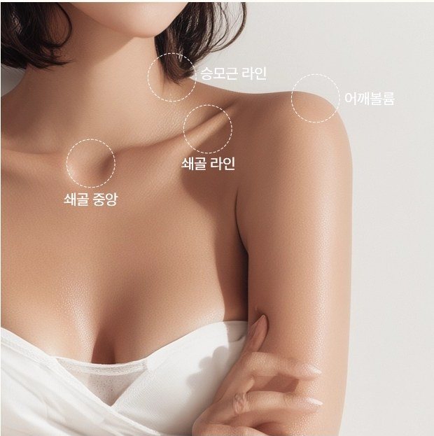 쇄골, 어깨, 승모근 라인이 드러난 여성의 상체 시술 부위 안내 사진 (쇄골 중앙, 승모근 라인, 쇄골 라인, 어깨볼륨 표시)