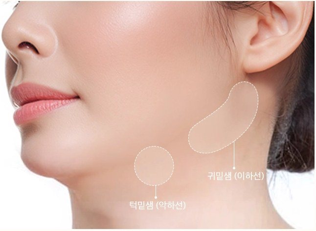 귀밑샘과 턱밑샘 위치가 표시된 여성의 턱과 목 라인
