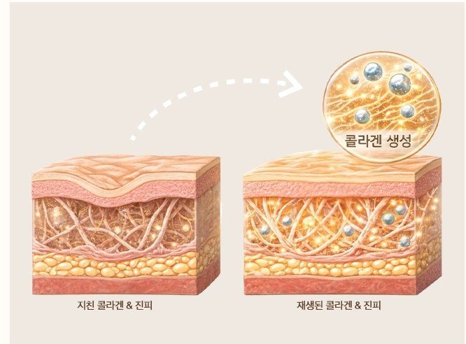 지친 진피와 콜라겐 재생 과정을 나타낸 피부 단면 일러스트