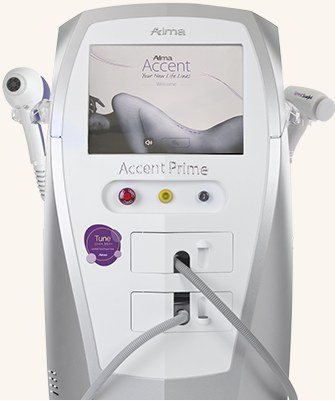 Accent Prime 튠페이스 시술 장비