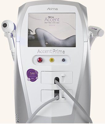 튠페이스 Accent Prime 시술 장비
