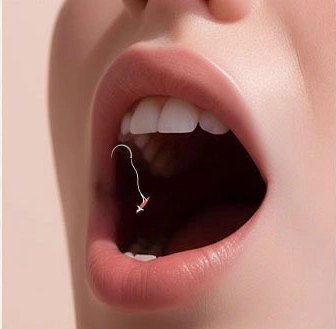 절개 부위를 봉합하는 일러스트