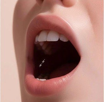 입안의 심부볼 지방 위치를 체크하는 일러스트