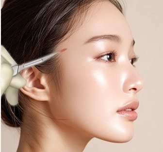 절개 시술 장면 일러스트