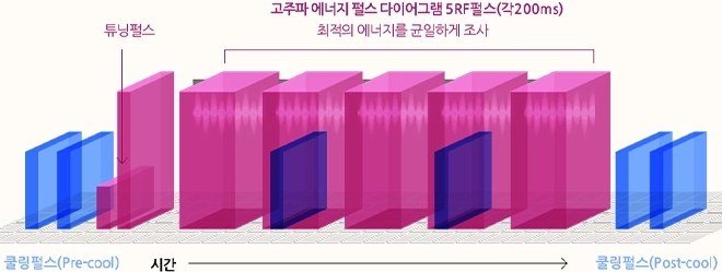고주파 에너지 펄스 다이어그램 및 쿨링펄스 전달 원리 그래프